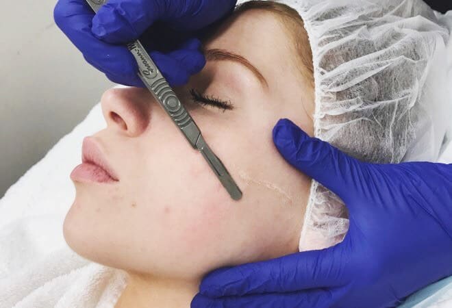 why dermaplaning